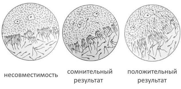 Результаты посткоитального теста будут готовы в день проведения