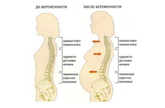 Боли в промежности и пояснице являются частыми спутниками беременности