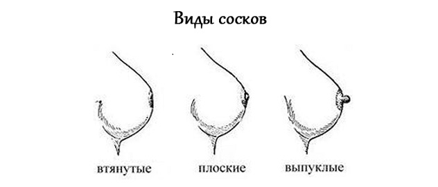 виды сосков при беременности