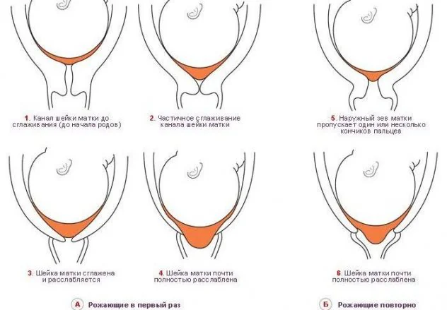 изменения цервикального канала в процессе вынашивания плода