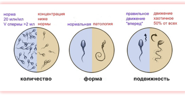 секреторное бесплодие у мужчин